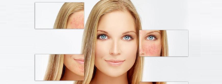 érdaganat, érelváltozások lézeres kezelése eltávolítása hemangioma budapest xi xxii xxi xxiii xx ix viii i xii